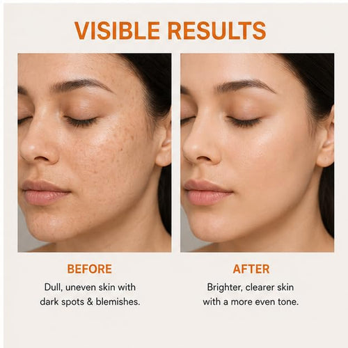 Elyndra Alpha Arbutin 2% Face Serum (30ml) - Brighter & Even Looking Skin