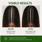 Elyndra Anti Dandruff Conditioner (200ml) - Hydration & Healthy Looking Hair
