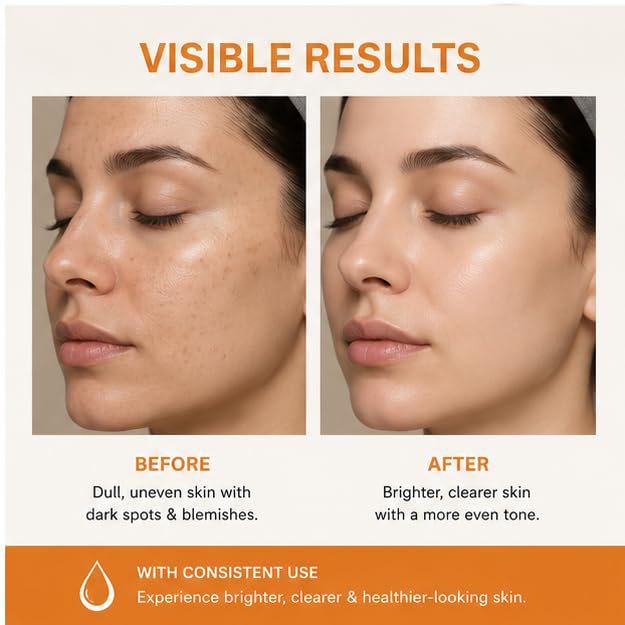 Elyndra Spot Removal Face Serum (30ml) - Brighter & Even Looking Skin