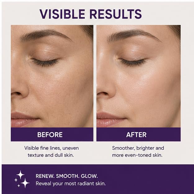 Elyndra Retinol 0.2% Face Cream (50g) - Smooth & Refined Looking Skin