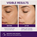 Elyndra Skin Lightening Cream (50g) - Brighter & Even Looking Skin