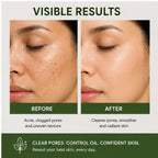 Elyndra Green Tea Face Wash with Built-In Soft Brush (150ml) - Deep Cleansing & Purifying Skin