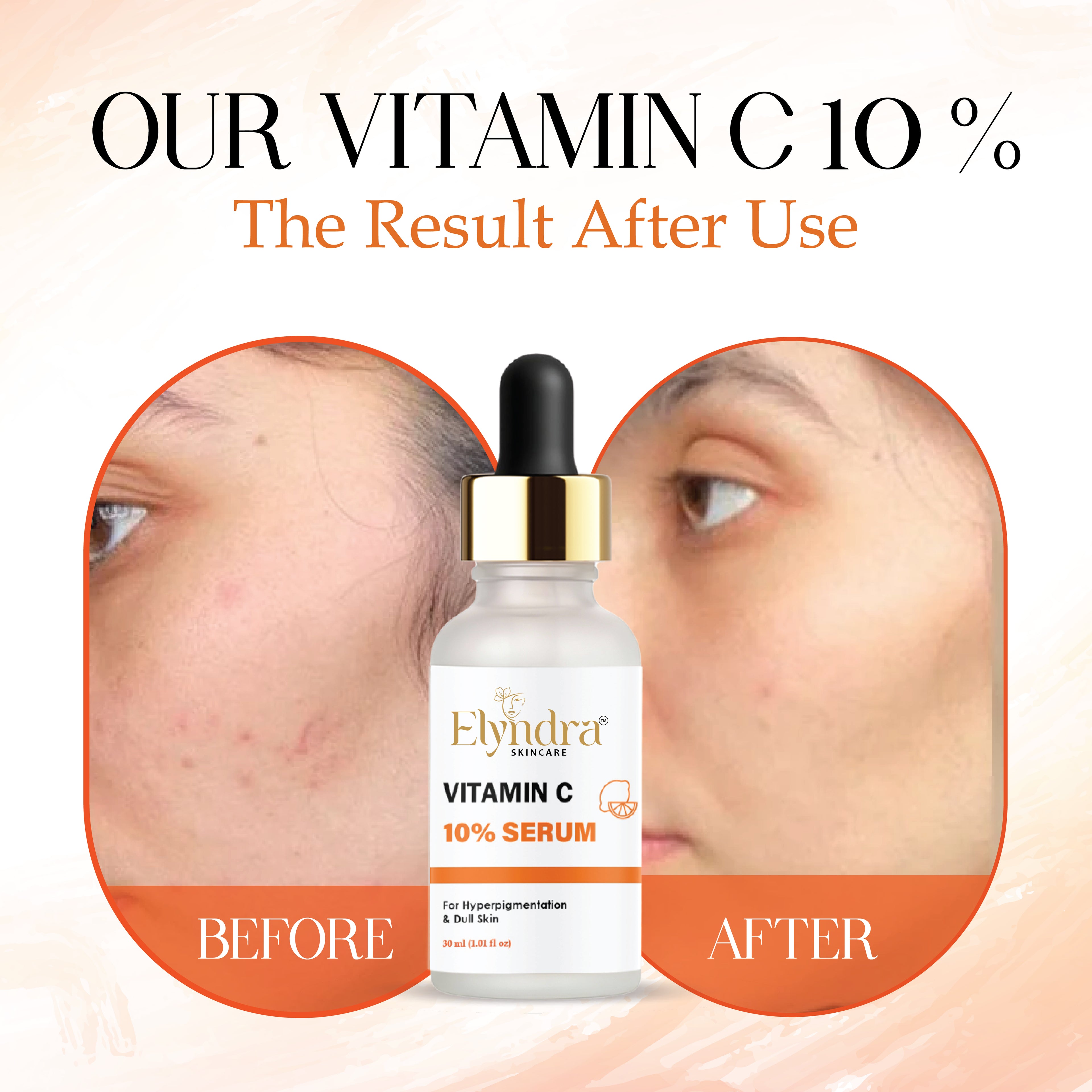 Elyndra Niacinamide Serum for Face Pore Minimizing Brightening Serum with Hyaluronic Acid Anti Aging Face Serum for Smooth Clear Even Skin Suitable for All Skin Types