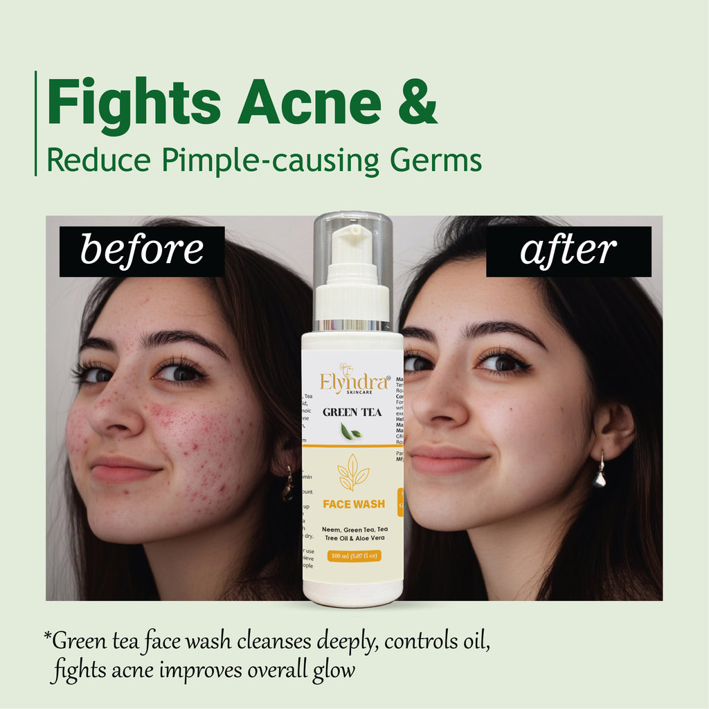 Elyndra Green Tea Face Cleanser – Oil Control & Gentle Hydration