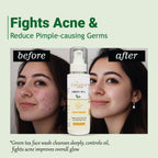 Elyndra Green Tea Face Cleanser (100ml) – Oil Control & Gentle Hydration